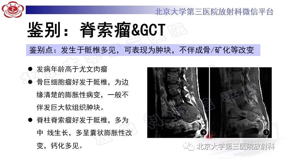 mpcg4zirxod2777.jpg
