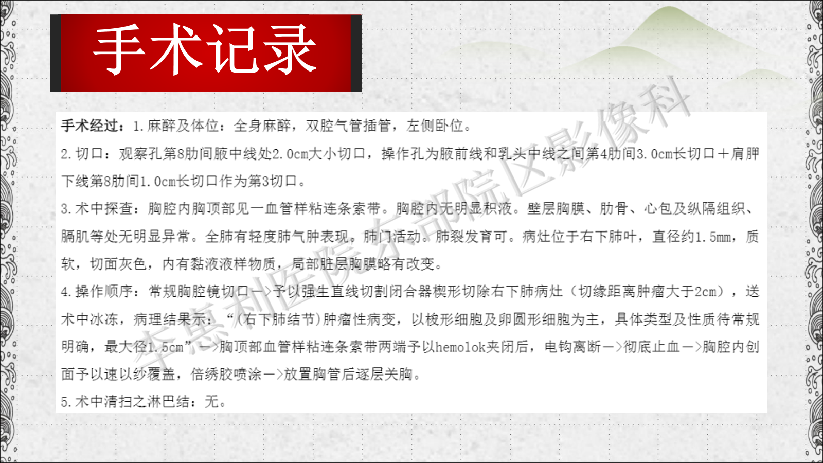 c5fp1mproum3458.png
