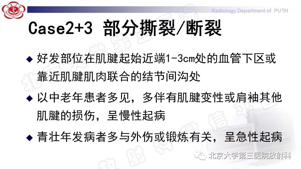 icnqf2shu514384.jpg