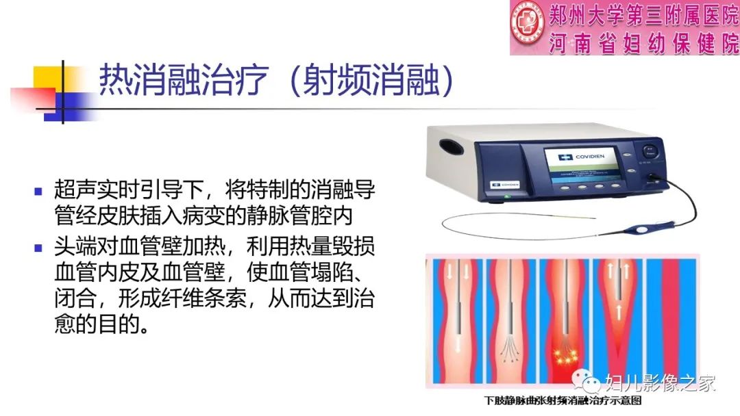 iw3bgokyulw5055.jpg