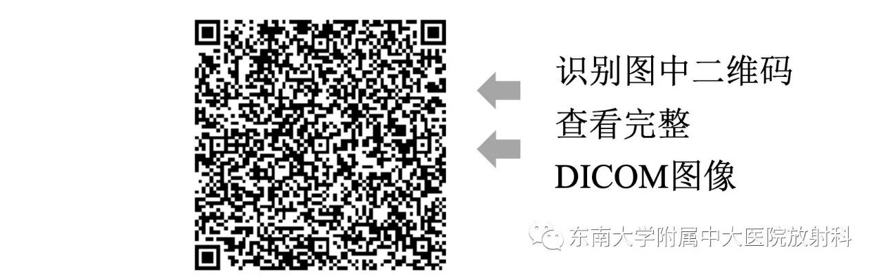 u4gi2rqhlb25140.jpg