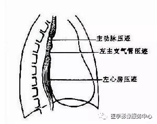 gp43o005xie6619.jpg