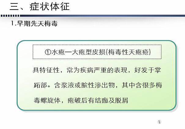 mc5mxmjk4dt8908.jpg