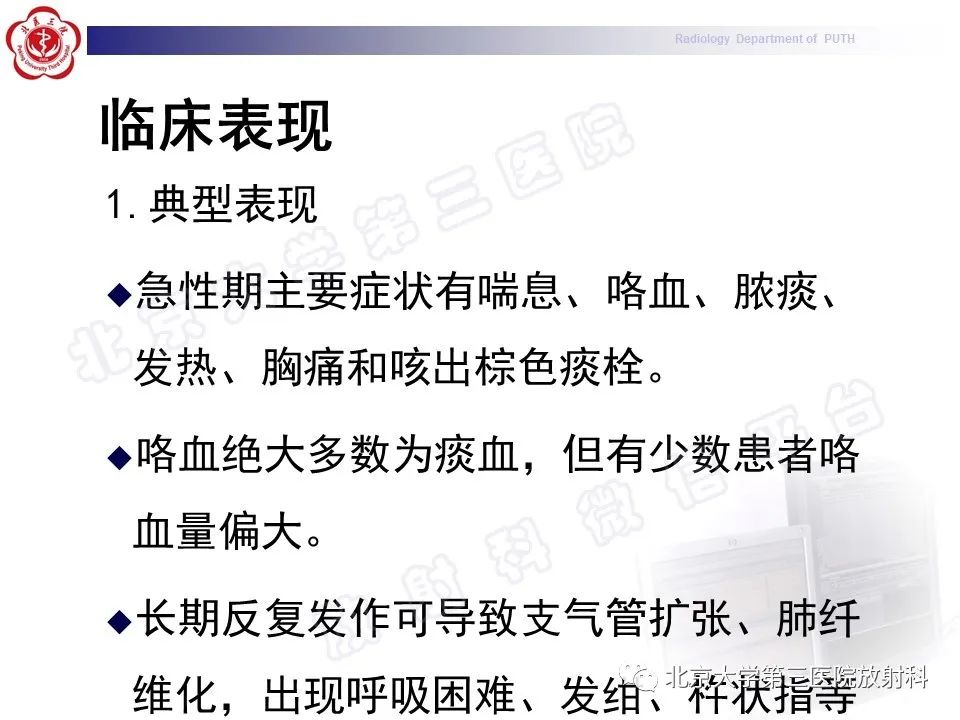 3gmlx4c1mbp11799.jpg