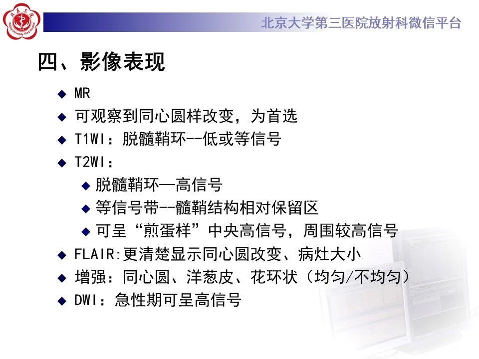 r1i0bi33qr512417.jpg