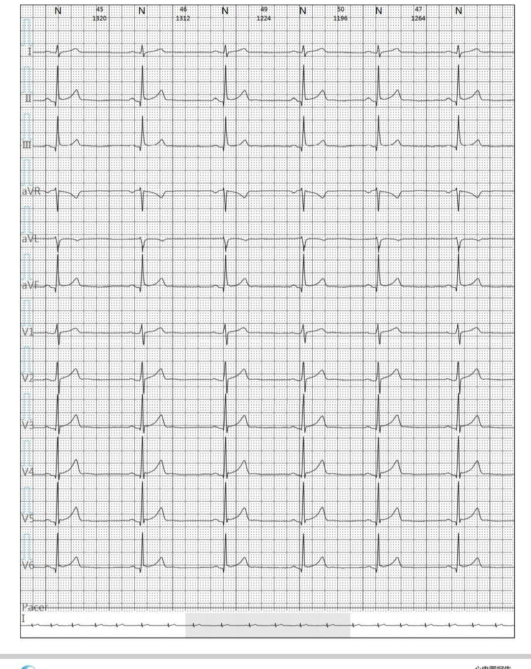 jxkmbbil1lb13519.jpg