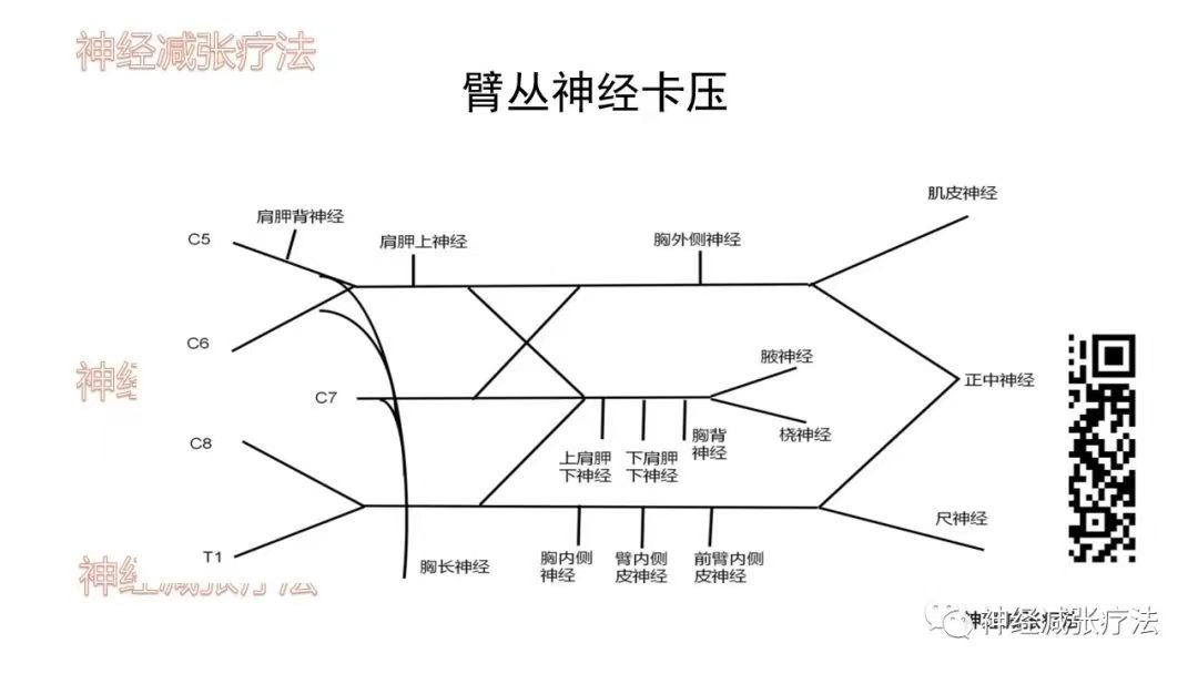 斜角肌损伤与上肢疼痛