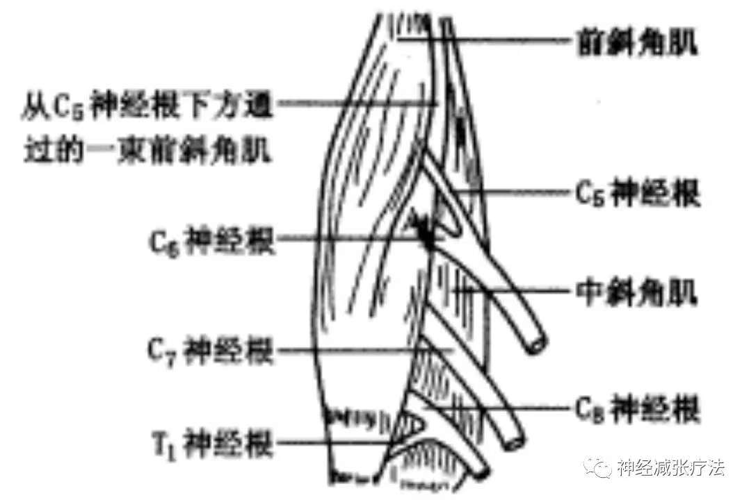 斜角肌损伤与上肢疼痛
